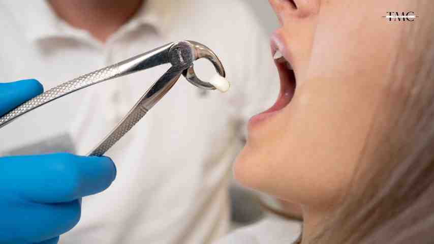 kill tooth pain nerve in 3 seconds permanently at home