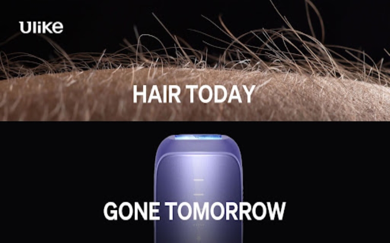 Pros and Cons of IPL Hair Removal Devices